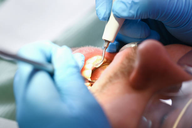 Best Emergency Dental Services for Seniors in San Leon, TX